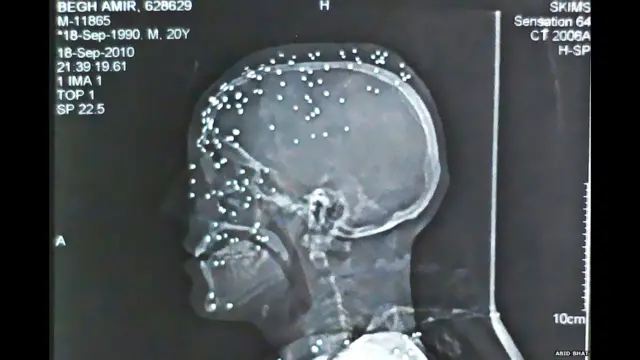 भारत प्रशासित कश्मीर, बंदूक के छर्रे, प्रभावित होती ज़िंदगी