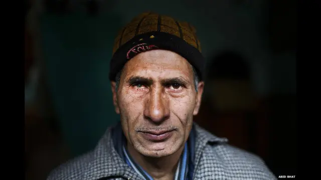 भारत प्रशासित कश्मीर, बंदूक के छर्रे, प्रभावित होती ज़िंदगी