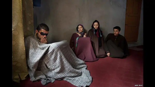 भारत प्रशासित कश्मीर, बंदूक के छर्रे, प्रभावित होती ज़िंदगी