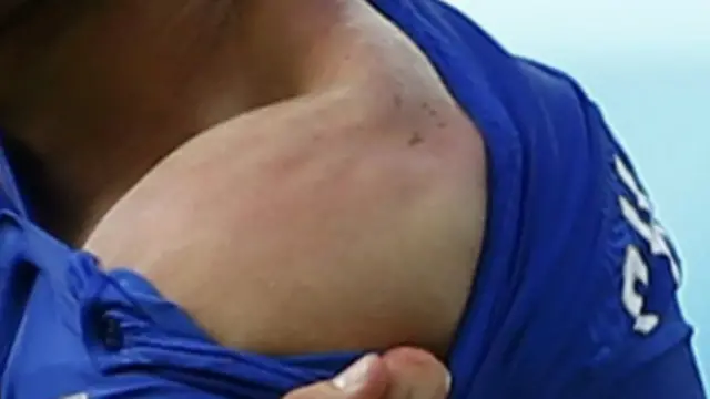 أزاح كيليني قميصه ليري الحكم آثار العضة على كتفه، ولكنه لم يتخذ اي اجراء