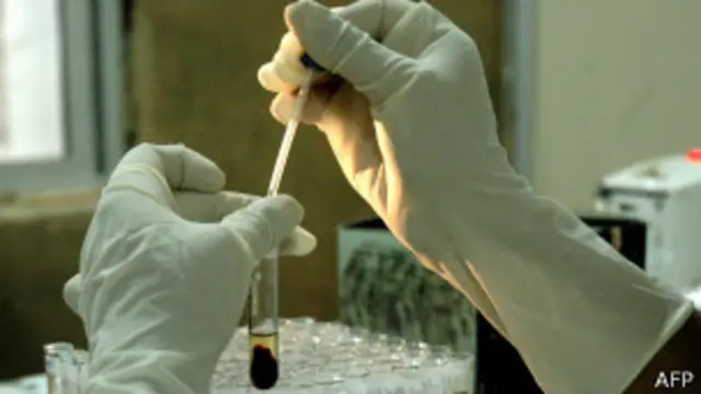 Тест на ВИЧ