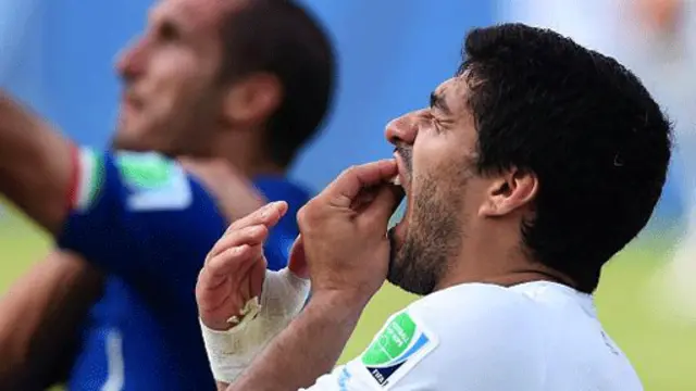 Luis Suarez sudah tiga kali menggigit pemain lawan