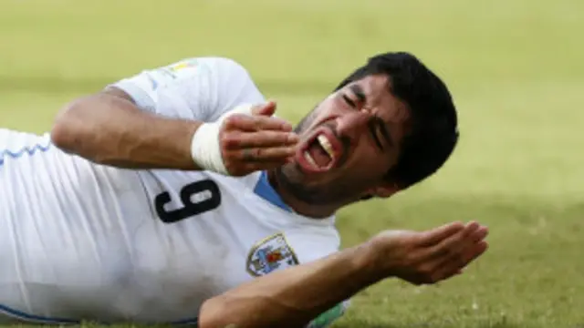 لویس سورایز له څلورو کلونو نه په کمه موده کې درې ځلې پر نورو لوبغاړو د لوبو پرمهال غاښونه لګولي.