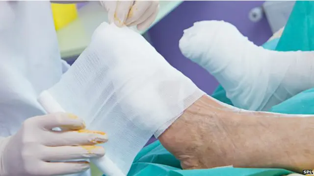 ذیابیطس کے مریضوں کے اعصاب کو شدید نقصان پہنچتا ہے