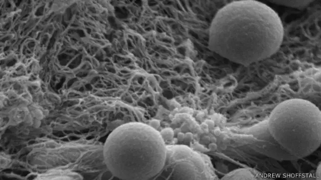 هذه الجزئيات الكروية الصغيرة أرفع من الشعرة 200 مرة