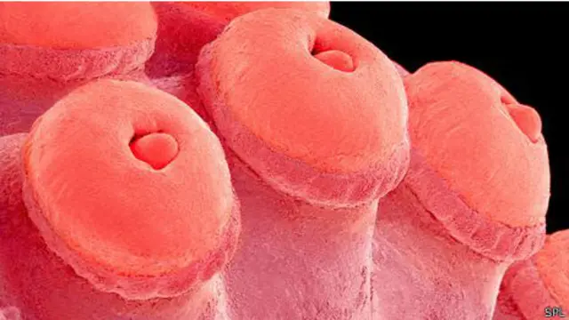 Ventosas de tentáculos del pulpo