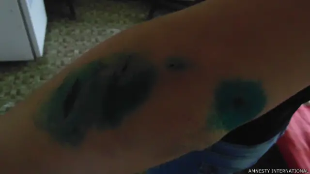 Порізи на руках Ганни