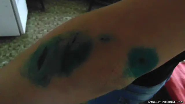 Порезы на руках Анны