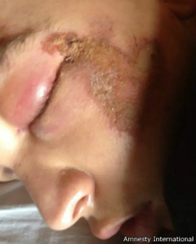 Побои на лице Саши