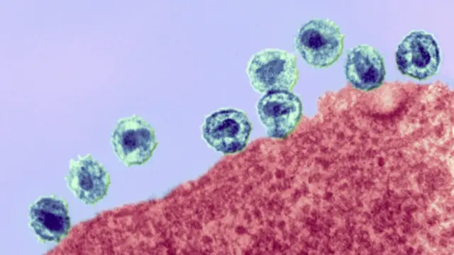 ’گذشتہ تین سالوں میں ایڈز سے ہونے والی اموات میں 20 فیصد کمی واقع ہوئی ہے‘