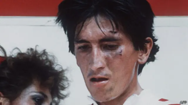 El rostro de Luis "Lucho" Herrera muestra los efectos de su caída en 1985.