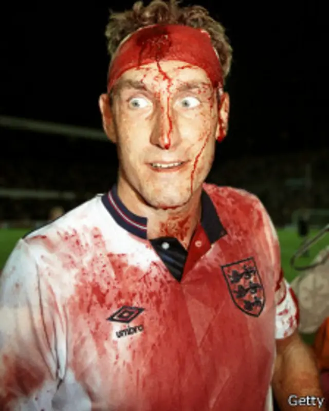 Butcher, el "carnicero" de Inglaterra.