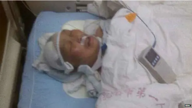 昆明火车站受害人之一石女士。她受伤后一直处于昏迷中。