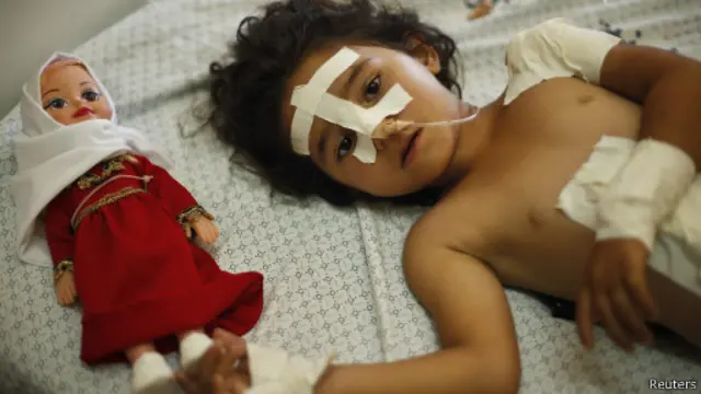 اسرائیلو په نهه ورځنیو بریدونو کې ۴۳ ماشومان وژلي او تر سلو ډېر نور یې ټپیان کړي.