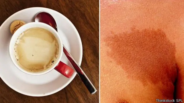 Manchas café con leche