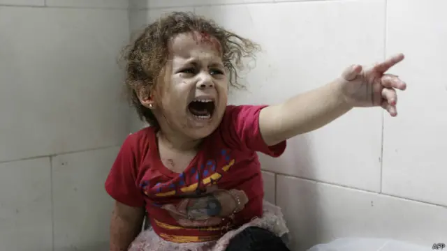 Niña palestina en un hospital de Gaza