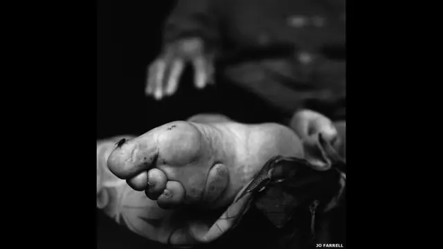 बाउंड फ़ीट, जो फ़ैरल