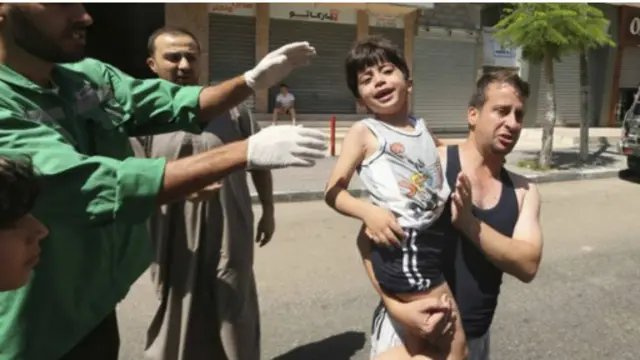 من بين ضحايا الهجمات الاسرائيلية الكثير من الاطفال. اصيب هذا الطفل في هجوم على غزة