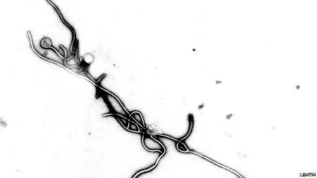 Вірус Ебола