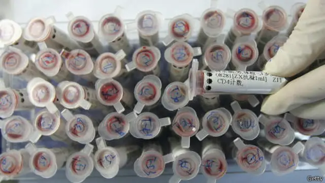 تقریبا ۷۵ درصد از تمام موارد جدید ابتلا فقط در ۱۵ کشور جهان روی میدهد