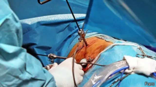 किडनी ऑपरेशन