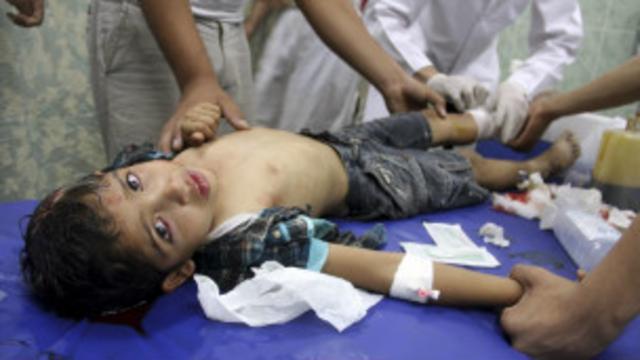 صبي فلسطيني يتلقى علاجات أولية