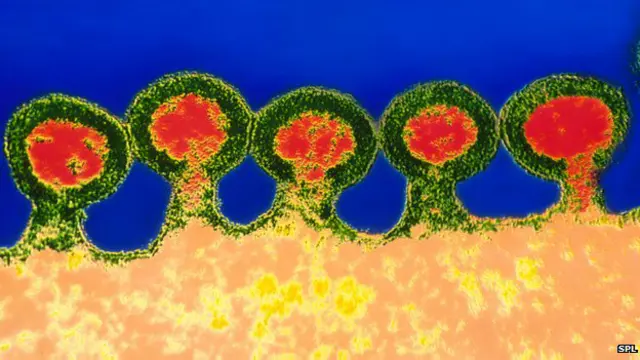 एचआईवी विषाणु