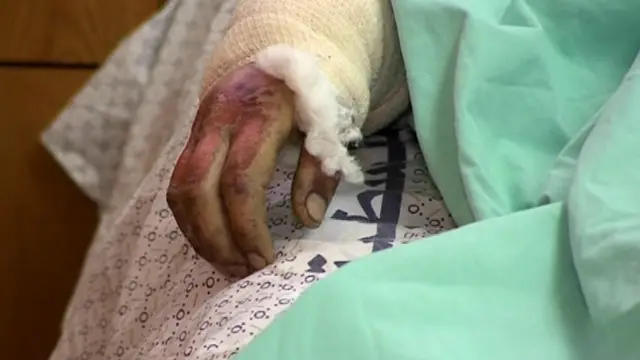 اقوام متحدہ کا کہنا ہے کہ غزہ میں مرنے والوں کی اکثریت عام شہری ہیں جن میں بہت سے بچے بھی شامل ہیں