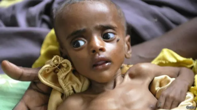 Голодающий ребёнок