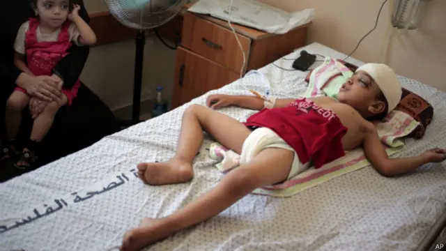 غزہ مرنے والے زیادہ تر عام فلسطینی شہری تھے جبکہ اسرائیل کے ہلاک ہونے والوں میں 33 اسرائیلی فوجی اہلکار تھے