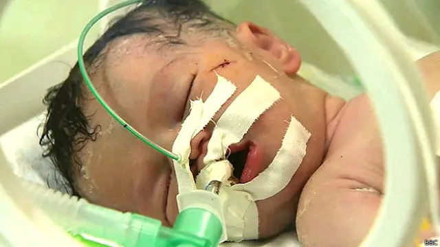 ग़ज़ा, नवजात