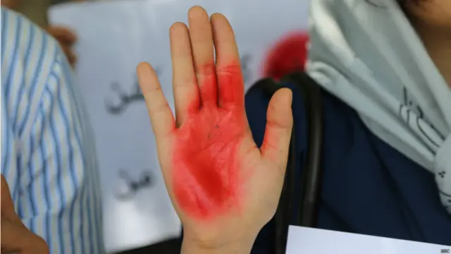 معترضان از شیوه های مختلف برای بیان خواست ها و انتقادهای شان استفاده کردند، از جمله هنر چیدمان تمثیل اعتراضی صحنه کشتار.