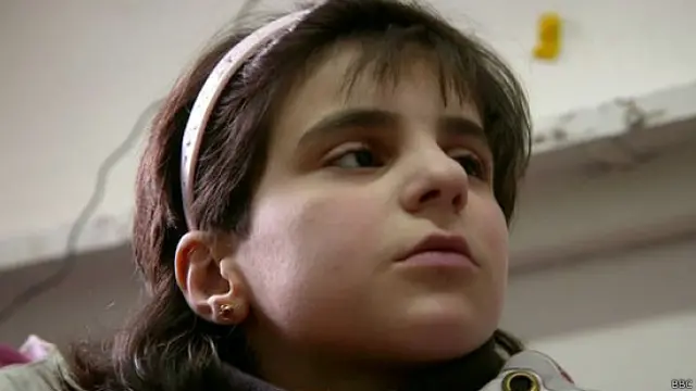 सीरियाई बच्ची