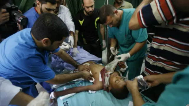 معظم الضحايا في غزة من المدنيين.