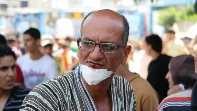 ملګرو ملتونو منلې چې په غزه کې د دوی پر درو مدرسو اسرائیلو بریدونه کړي. 