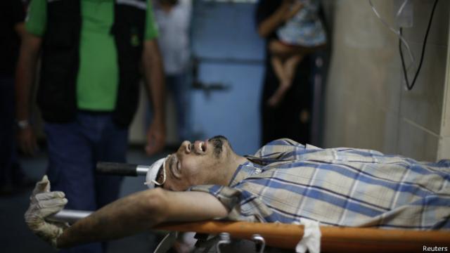 Palestino ferido em hospital em Gaza. Credito: Reuters