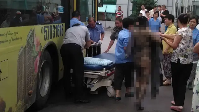 爆炸发生时，造成100多人烧伤，当局正在组织烧伤专家赶赴医院抢救。