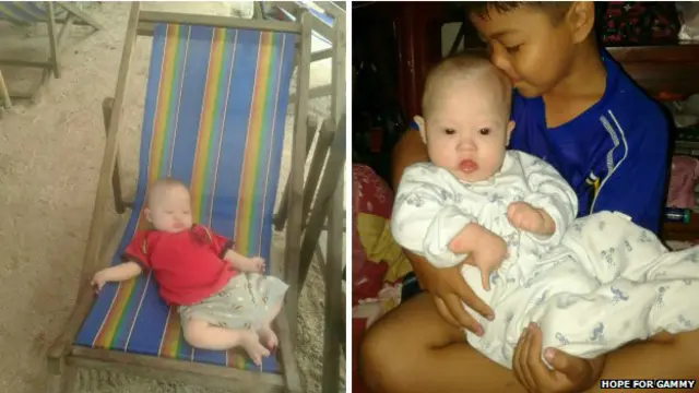 Родной и суррогатный ребенок Паттарамон Чанбуа