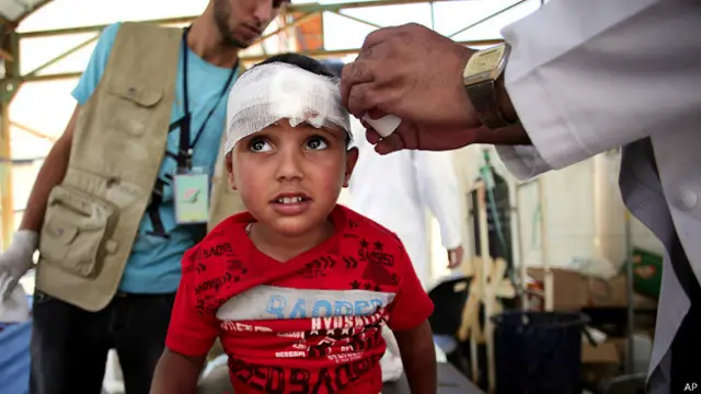 Niño palestino herido