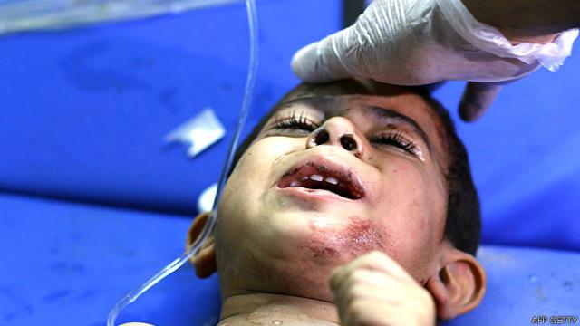 Niño herido en Gaza