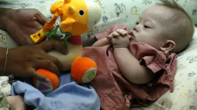 ඕස්ට්රේලියානු යුවල විසින් අත්හැර ගිය මානසික ආබාධයෙන් පෙළෙන බිලිඳා