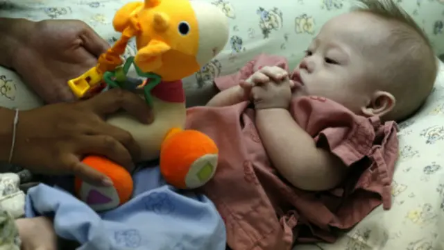 被一对澳大利亚夫妇遗弃的在泰国代孕的患有唐氏综合症的男婴甘米。