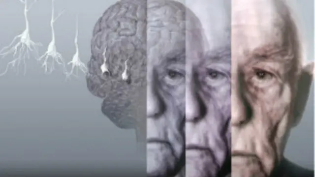 Se estima que unas 850.000 personas padecen de demencia en Reino Unido.