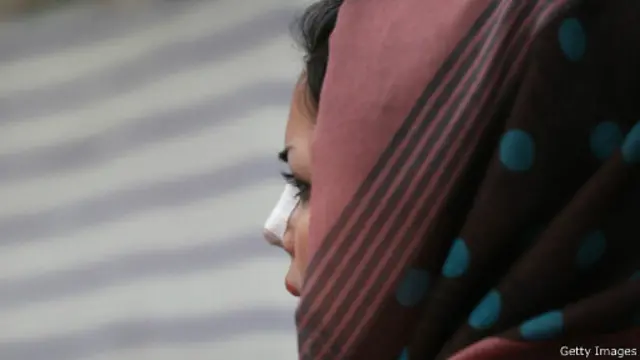  ایران از نظر تعداد جراحی بینی در دنیا پنجم است