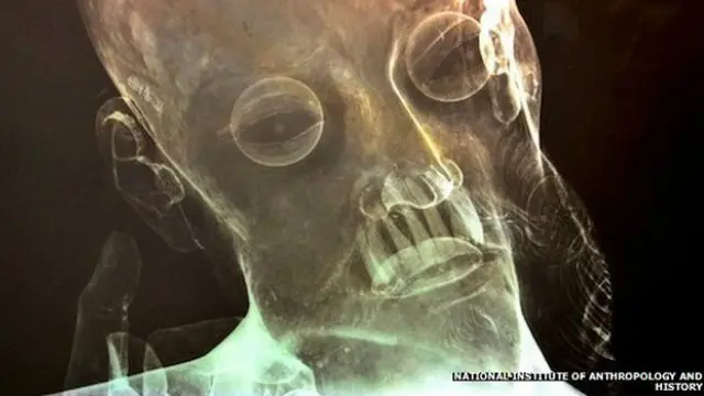 मैक्सिको, ईसामसीह की प्रतिमा, एक्सरे