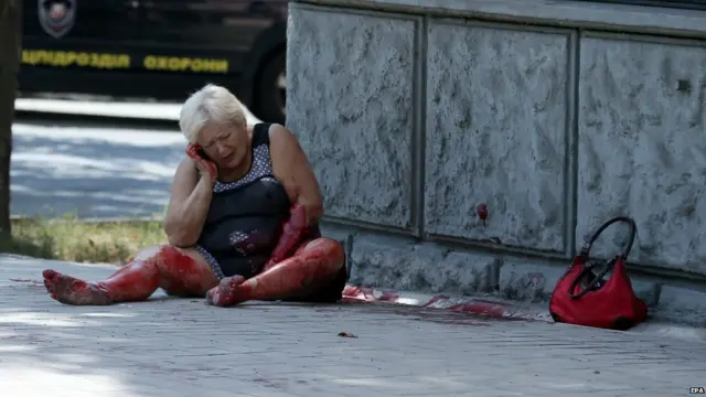 Раненая женщина после взрыва мины