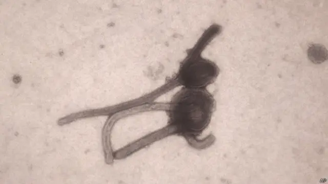 Los científicos estudian el virus para tratar de desarrollar una vacuna.