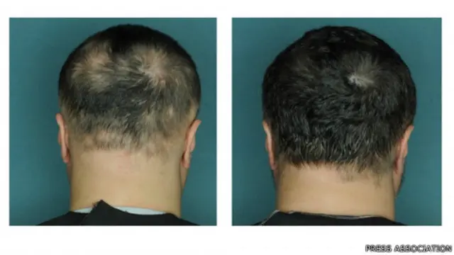 Tahap pengobatan lanjutan