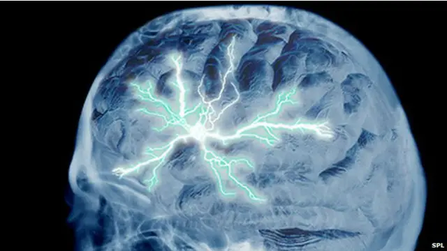 मनुष्य का दिमाग