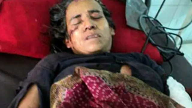 کملا نیگی کی تقریباً نصف گھنٹے تک چیتے سے اس سے لڑائی جاری رہی